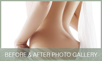 Cosmetic Surgery Before and After Pictures in Orlando, FL