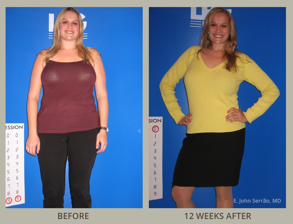 Weight Loss & Wellness Center Before and After Pictures Orlando, FL
