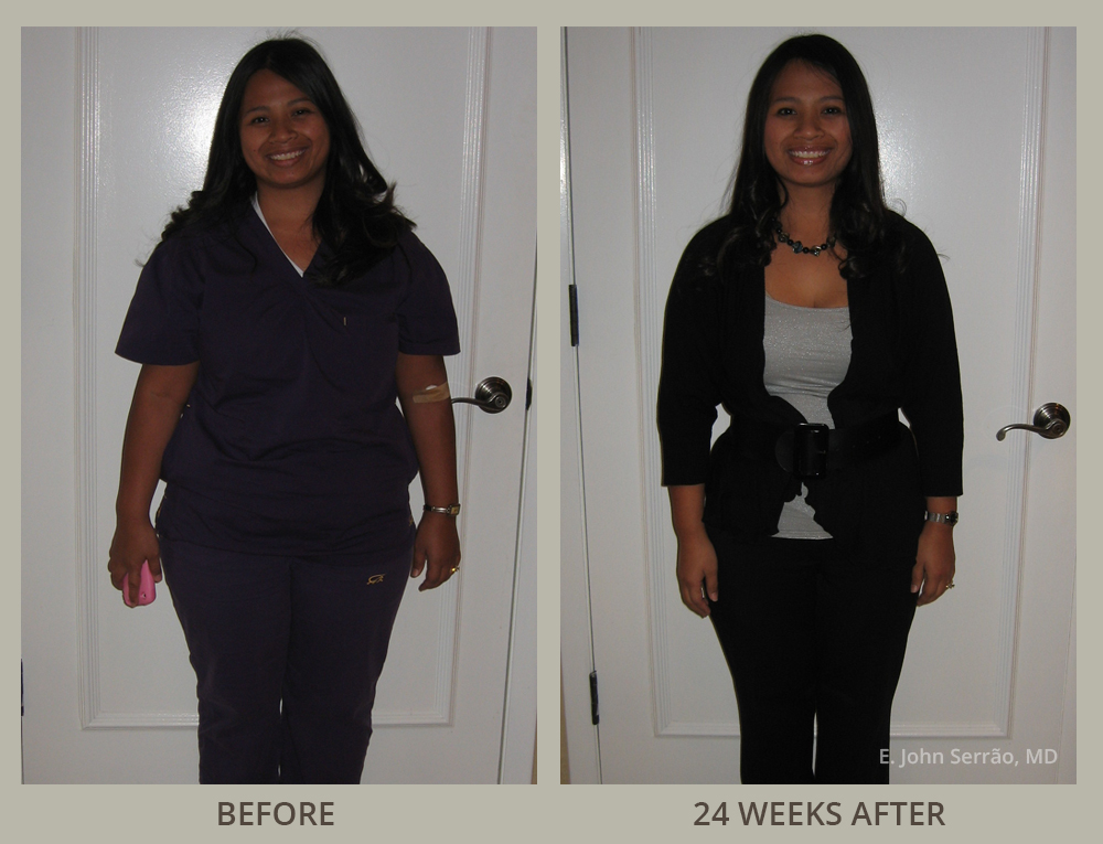 Weight Loss & Wellness Center Before and After Pictures Orlando, FL